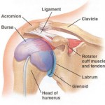 shoulder-pain-2