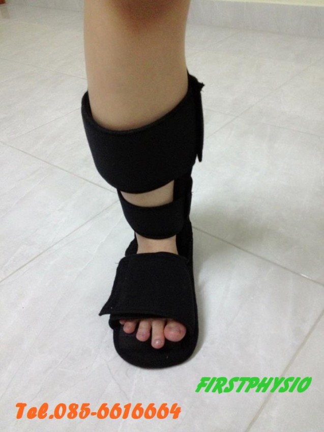 อุปกรณ์ดามกันเท้าตก (AFO ankle foot orthosis)