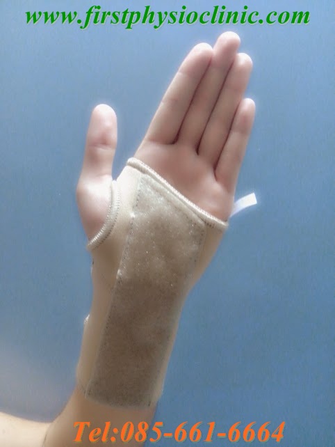 อุปกรณ์พยุงข้อมือ..แบบมีแกนเหล็กเสริม (Wrist splint)