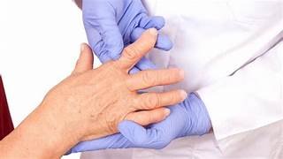 ตอนที่ 726 การรักษาโรครูมาตอยด์ (Rheumatoid Arthritis)